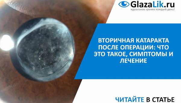 лечение вторичной катаракты глаза